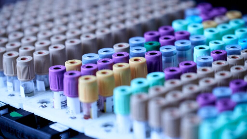 Labs